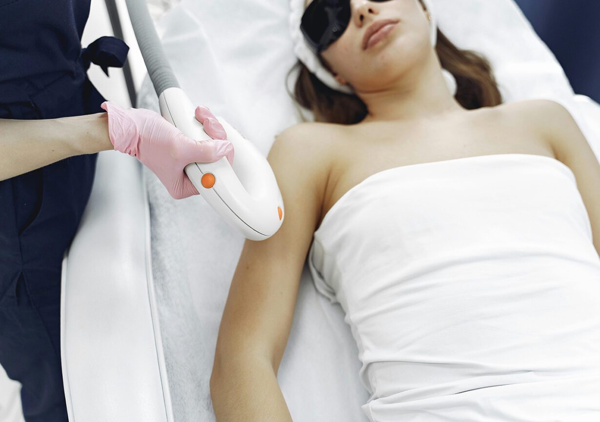 Séance d'épilation laser à Lyon