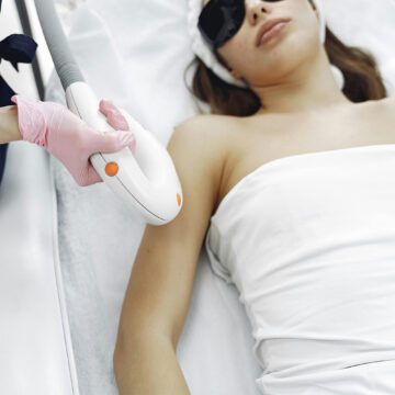 Séance d'épilation laser à Lyon